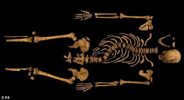 The hunchback king: The skeleton, unearthed in a dig last September, showed evidence of the same curvature of the spine and battle injuries thought to have been suffered by the last Plantagenet king